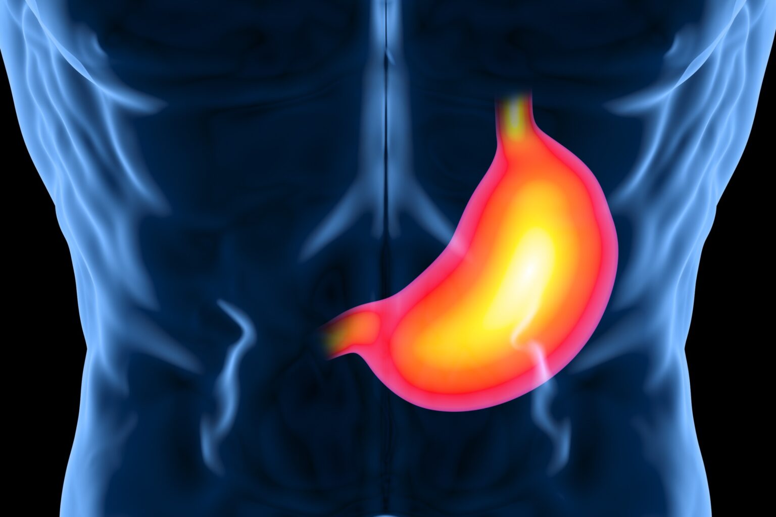 heartburn-symptoms-northern-light-eastern-maine-medical-center